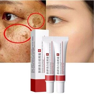 2 Pcs Freckle Cream Acne Scar Removal Treatment Cream Pigmentation Removal Cream